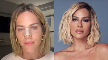 Giovanna Ewbank surge na web após cirurgia no nariz: “Precisava fazer” - Instagram