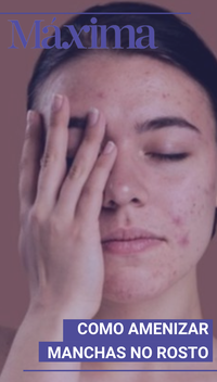 Como amenizar manchas no rosto