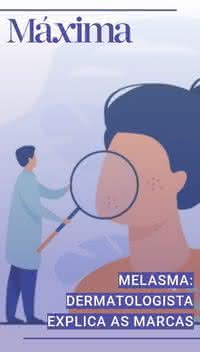 Melasma: dermatologista explica as marcas