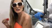 Andressa Urach está removendo tatuagens antigas - YouTube