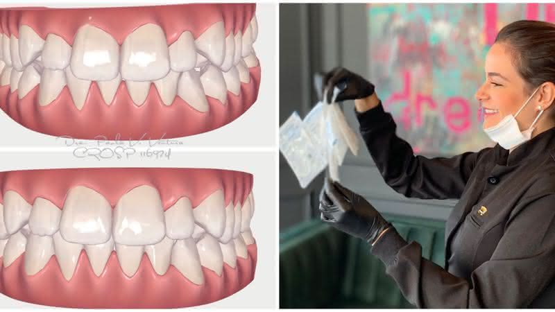 Dra. Paola Ventura apresenta novas tecnologias odontológicas - Instagram