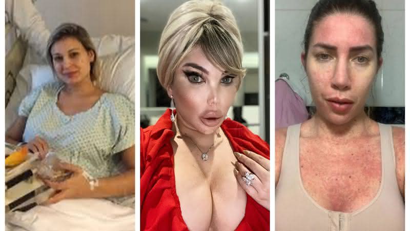 Relembre as famosas que quase perderam a vida por cirurgias plásticas - Instagram