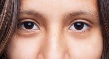 Dra. Priscilla Martelli orienta sobre os melhores tratamentos para a área dos olhos - Freepik