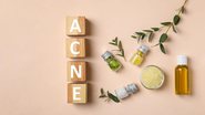 Cuidados simples do dia a dia podem ajudar a combater a acne (Imagem: New Africa | Shutterstock)