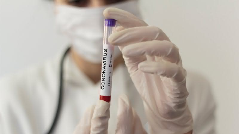 Brasil tem 76 casos confirmados de novo coronavírus, segundo o Ministério da Saúde - GettyImages