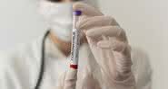 Brasil tem 76 casos confirmados de novo coronavírus, segundo o Ministério da Saúde - GettyImages
