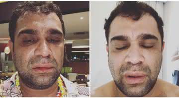 Evandro Santo é agredido após show em Marília - Instagram