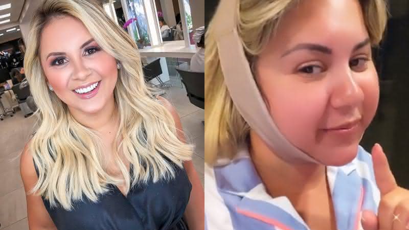 Natália Toscano passa por cirurgia corretiva: "Estava nos meus planos" - Reprodução/ Instagram