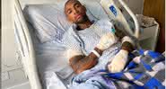 Nego do Borel hospitalizado após acidente de moto - Instagram