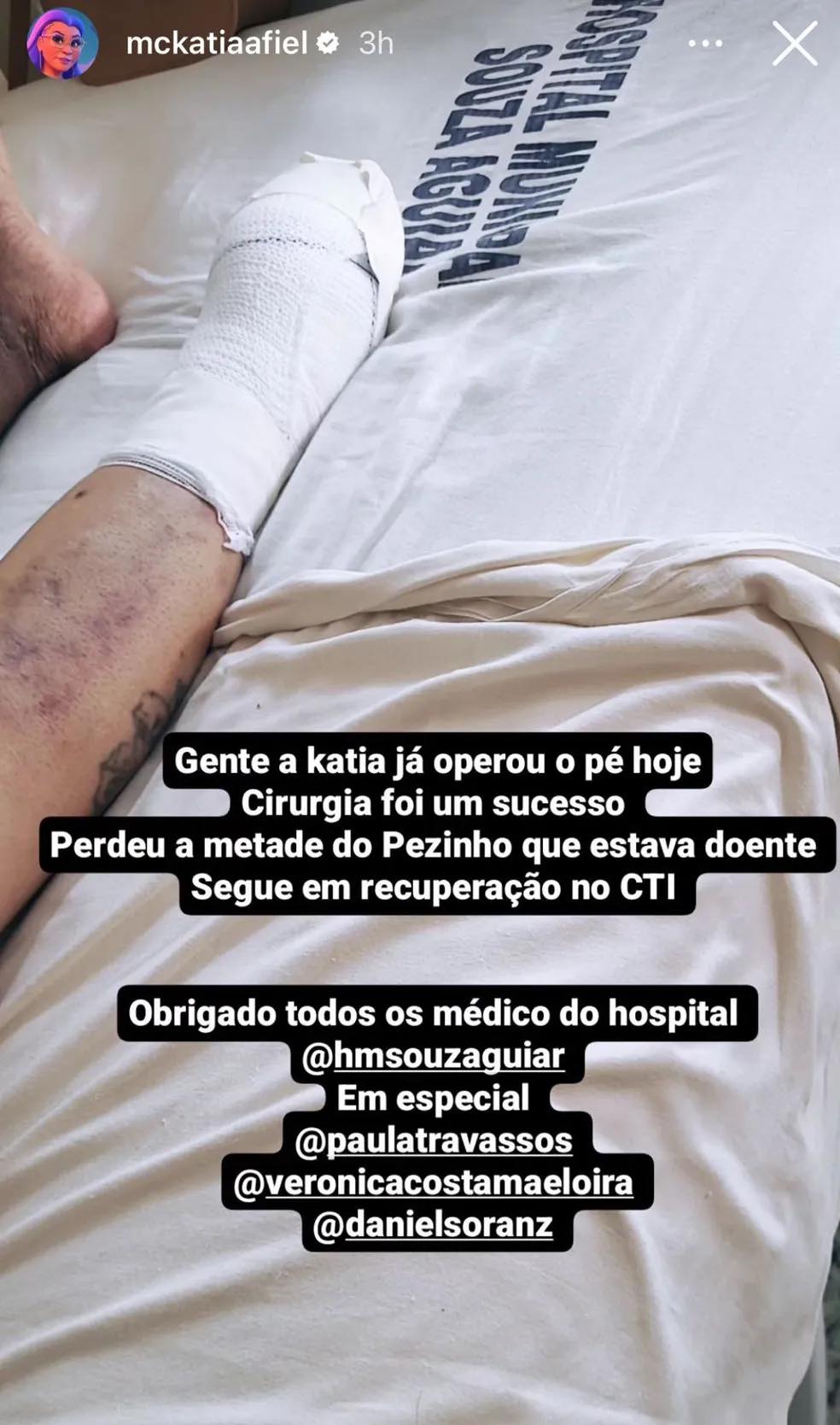 MC Kátia mostra pé amputado após cirurgia delicadíssima