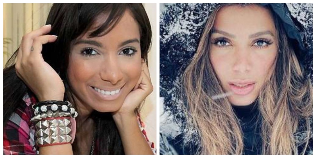 Veja o antes e depois de Anitta