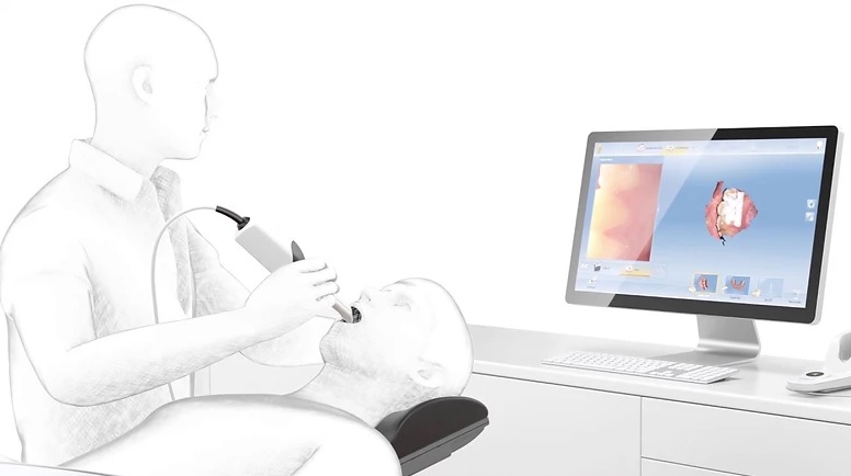 Escaneamento bucal chega para ajudar na identificação de problemas odontológicos